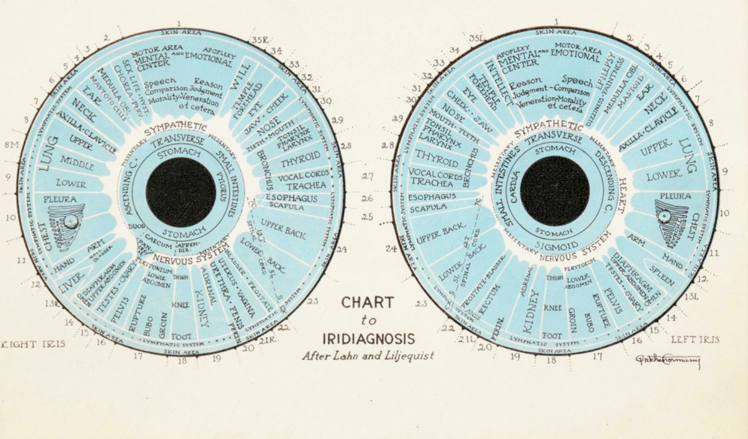 Iris-Topografie nach Lahn und Liljequist